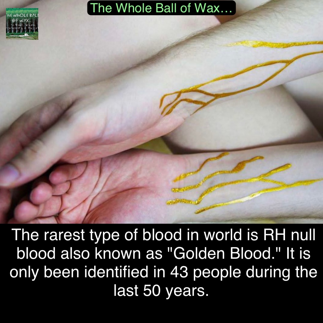 Double tap to edit The rarest type of blood in world is RH null blood also known as "Golden Blood." It is only been identified in 43 people during the last 50 years.