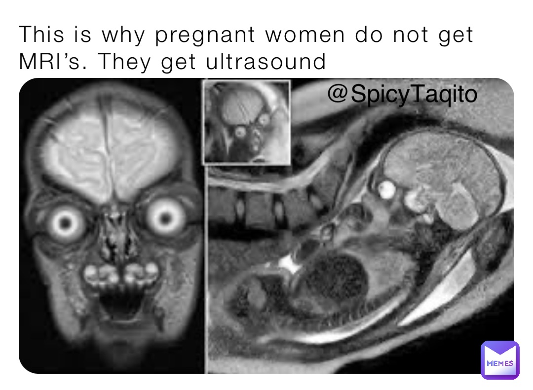 This is why pregnant women do not get MRI’s. They get ultrasound