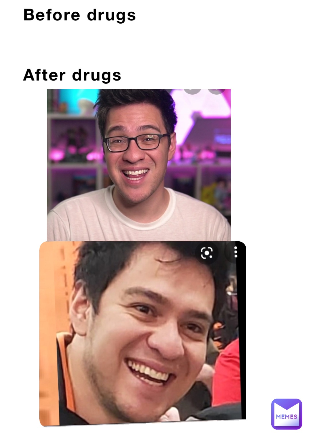 Before drugs 


After drugs