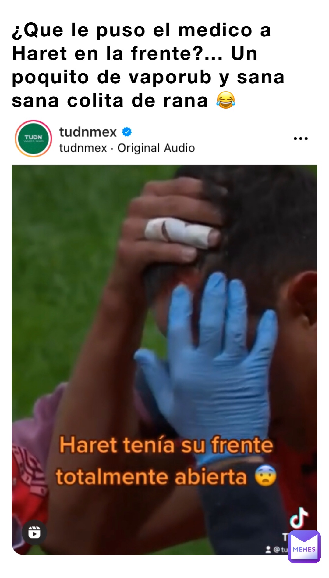 ¿Que le puso el medico a Haret en la frente?... Un poquito de vaporub y sana sana colita de rana 😂