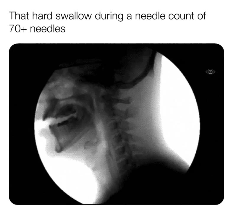 #nurse   #darkhumormemes   #worklife   #healthcare   #CST    #medicalmemes   #hospitallife   #ORscrub   #callLife   #sterilefield   #highstrung   #surgery   #surgeryhumor   #cabg   #heartsurgery   #heartsurgery   #generalsurgery   #neurosurgery   #vascularsurgery   #obgynsurgery   #operationroom   #damnwelostaneedleonaBV-1   #onmykneewtofindthislostneedle   #wheresthemagstick    #callcounting