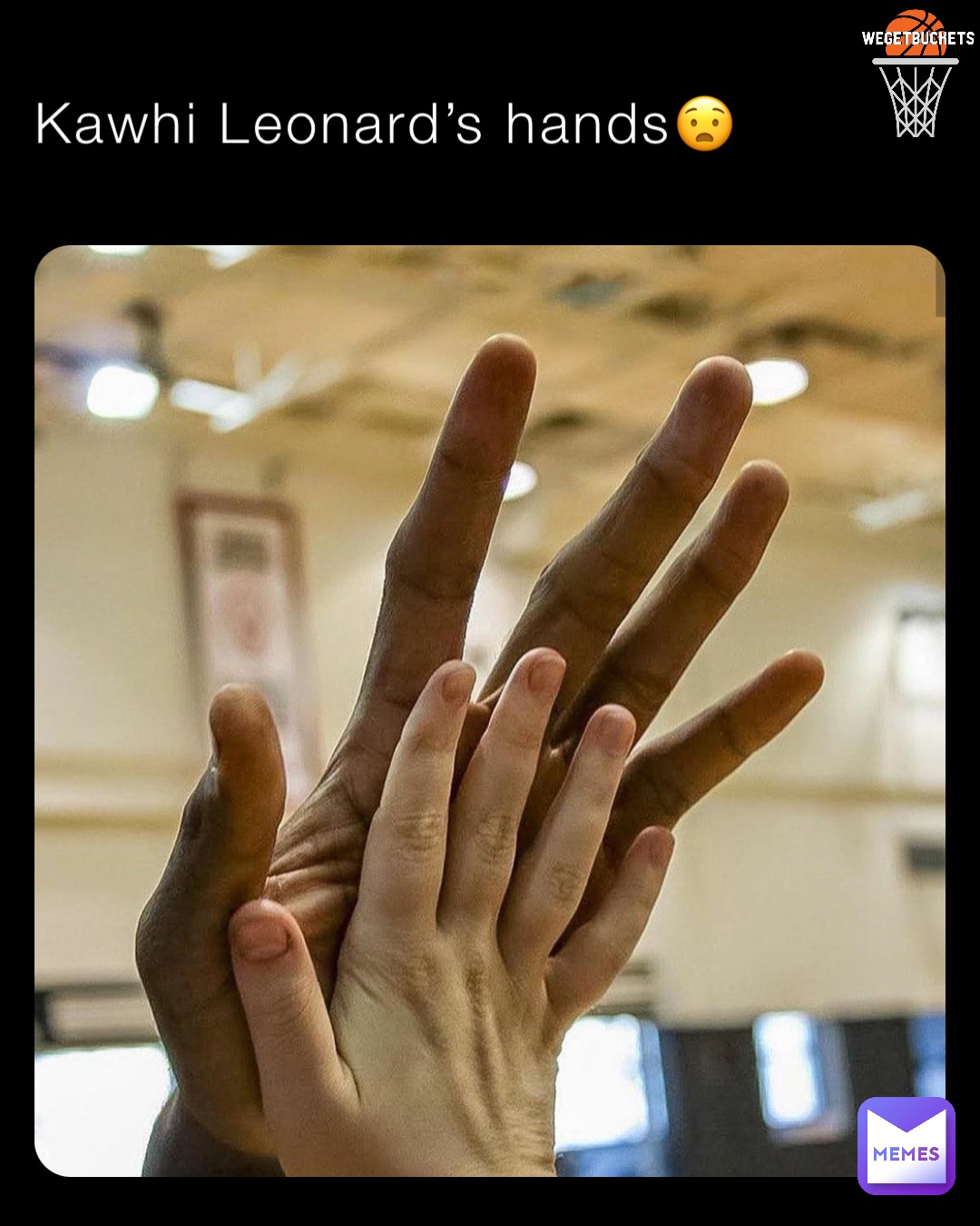 Kawhi Leonard’s hands😧