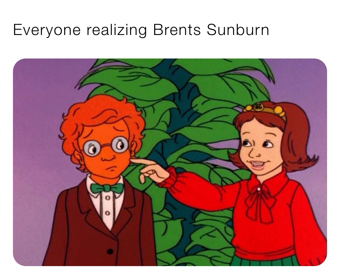 Everyone realizing Brents Sunburn