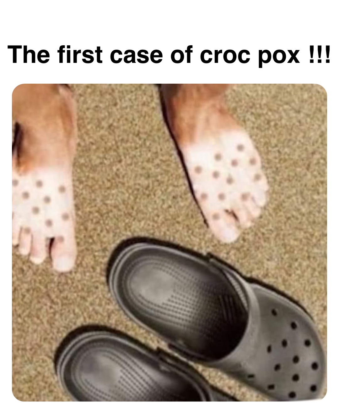 Double tap to edit The first case of croc pox !!!