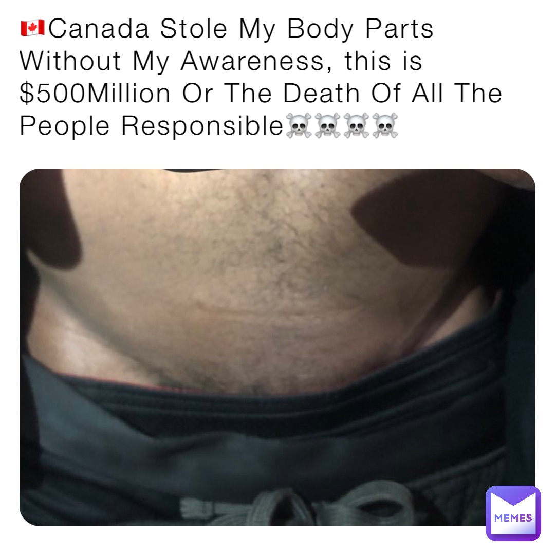 🇨🇦Canada Stole My Body Parts Without My Awareness, this is $500Million Or The Death Of All The People Responsible☠️☠️☠️☠️ 🇨🇦Canada Stole My Body Parts Without My Awareness, this is $500Million Or The Death Of All The People Responsible☠️☠️☠️☠️