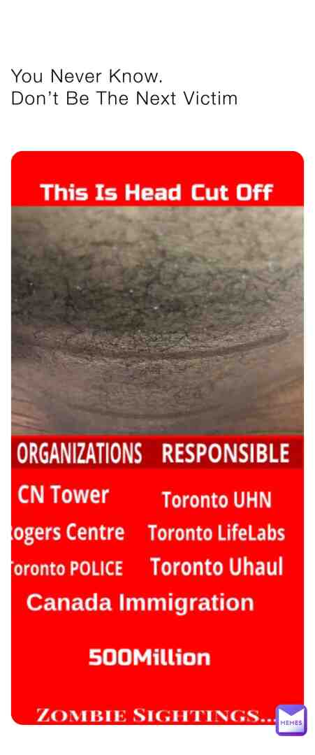 #humanity #technology #nature #canadamemes #canada #toronto #photooftheday #reality #news #viral #explorepage #human #body #life #doctor #surgeon #health #memesdaily #meme #memes #rogerscentre #rogers #cntower #illustration #art #trending #damages #ecosystem #environment #death #mortal #news #time #immortal #god
