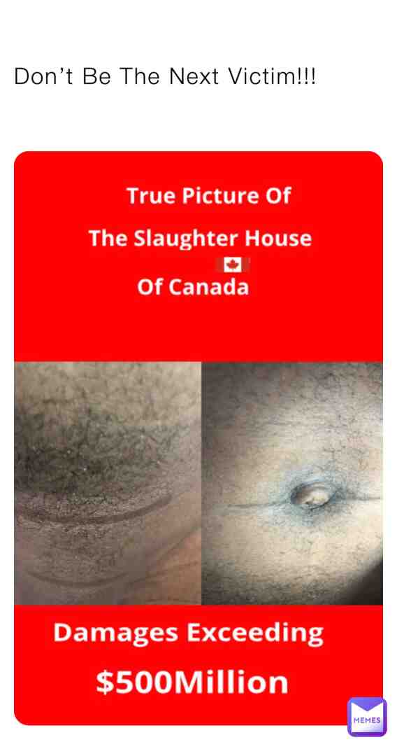 #humanity #technology #nature #canadamemes #canada #toronto #photooftheday #reality #news #viral #explorepage #human #body #life #doctor #surgeon #health #ontario #zombie #consciousness #landscape #nature #discover #write #time #news #blood #rogerscentre #rogers #cntower #illustration #art #trending