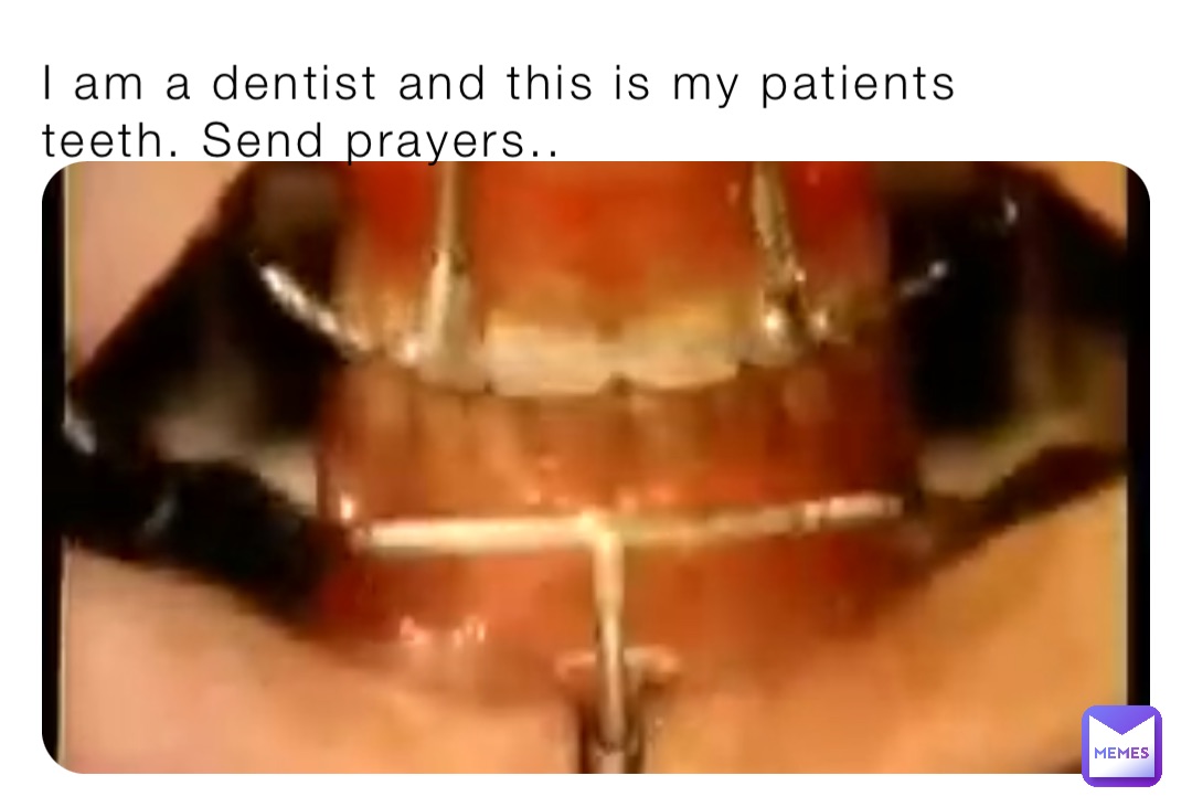 I am a dentist and this is my patients teeth. Send prayers..
