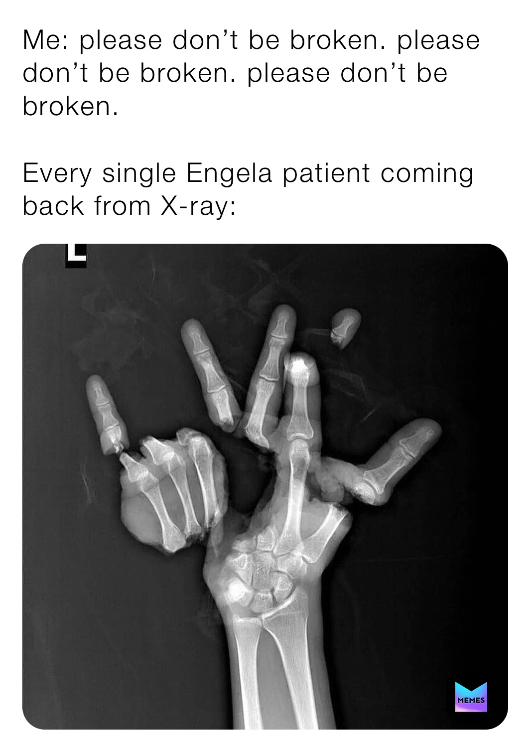 Me: please don’t be broken. please don’t be broken. please don’t be broken.

Every single Engela patient coming back from X-ray: