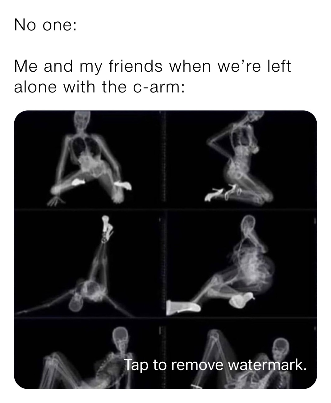 No one:

Me and my friends when we’re left alone with the c-arm: