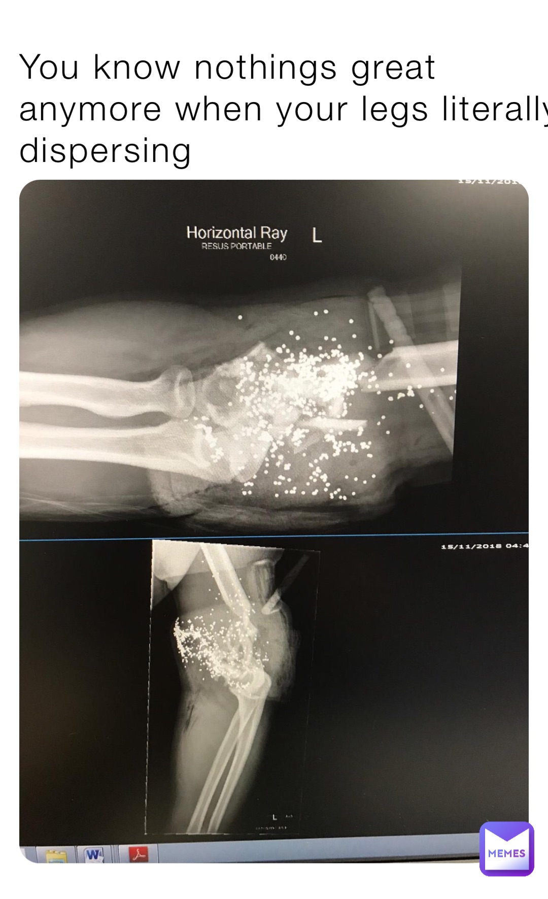 You know nothings great anymore when your legs literally dispersing