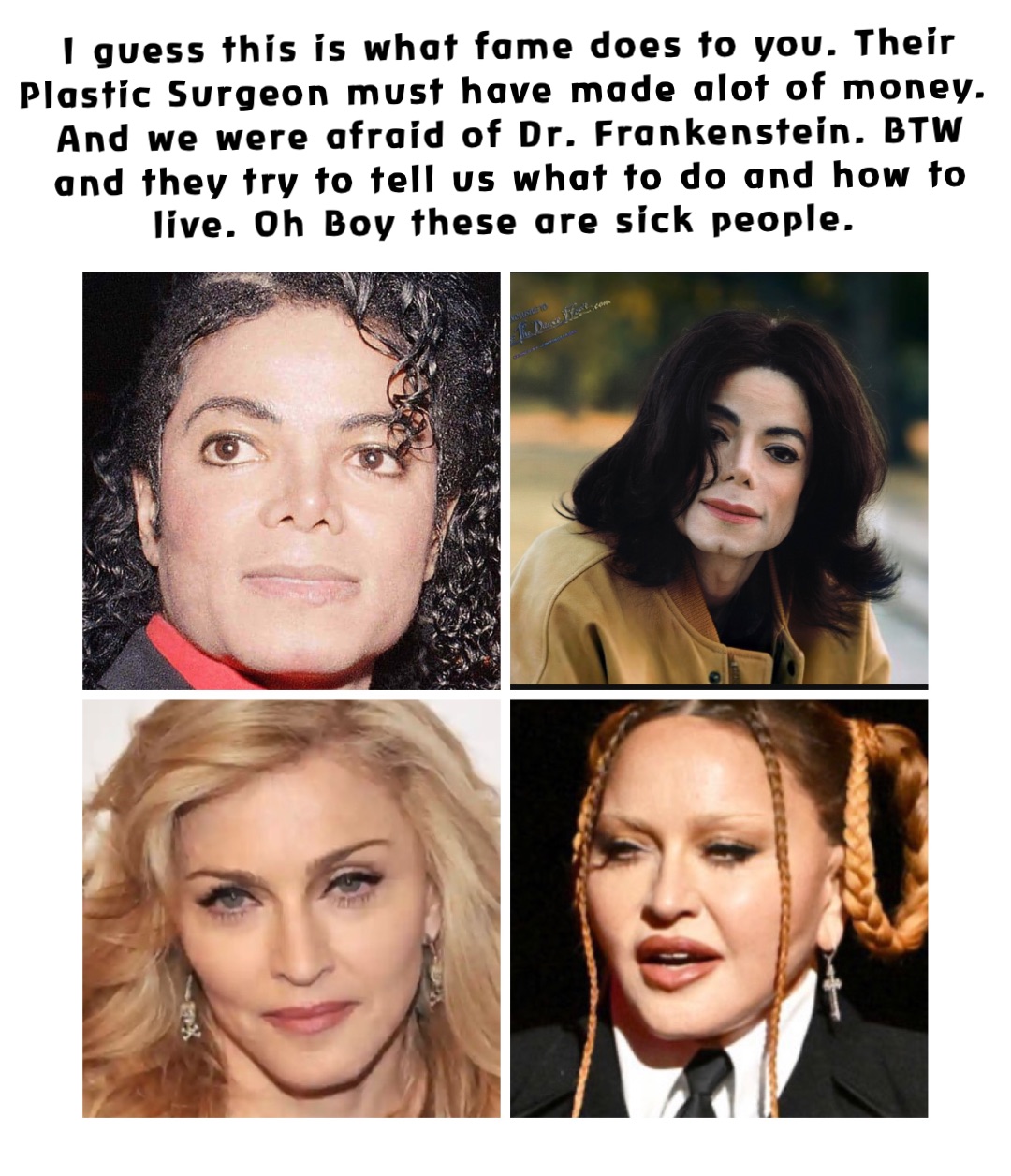 I guess this is what fame does to you. Their Plastic Surgeon must have made alot of money. And we were afraid of Dr. Frankenstein. BTW and they try to tell us what to do and how to live. Oh Boy these are sick people.