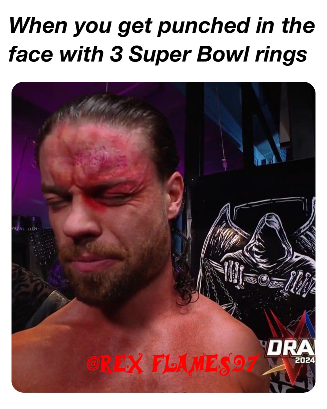 When you get punched in the face with 3 Super Bowl rings