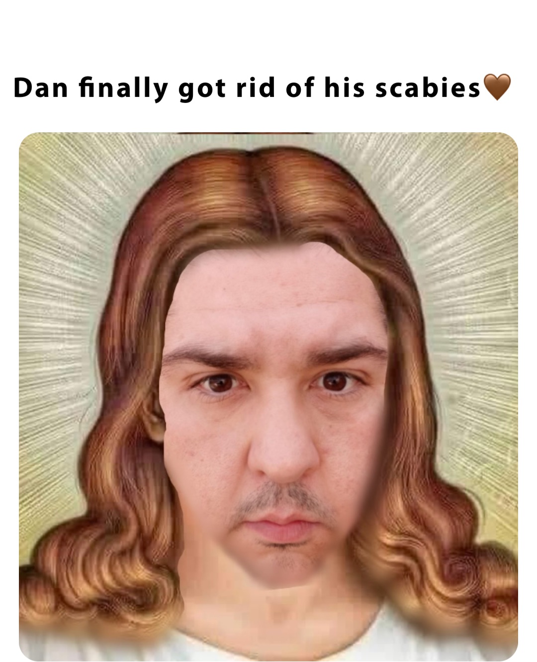 Dan finally got rid of his scabies🤎