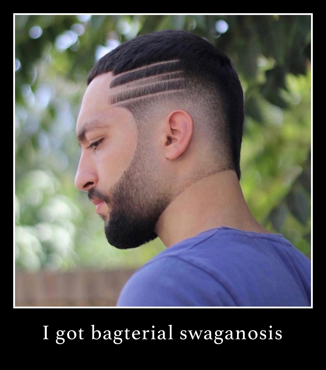 I got bagterial swaganosis 