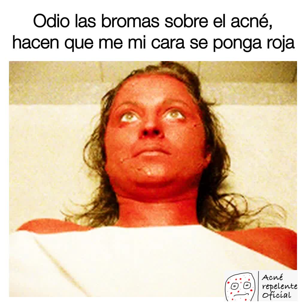 Y esa Luz roja en mi cara : r/MemesESP