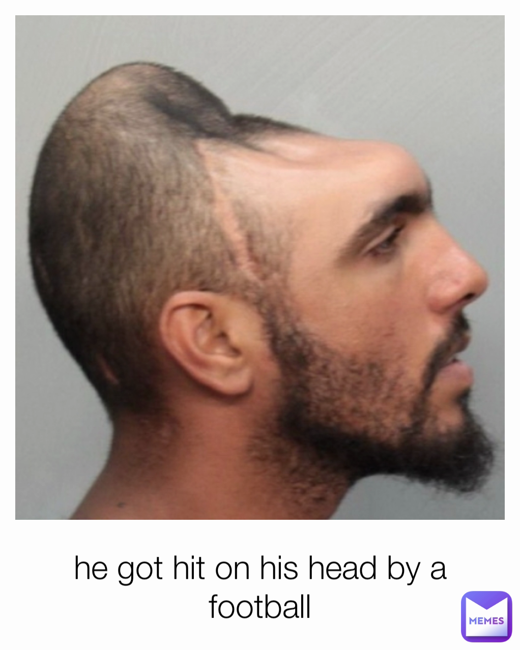 he got hit on his head by a football