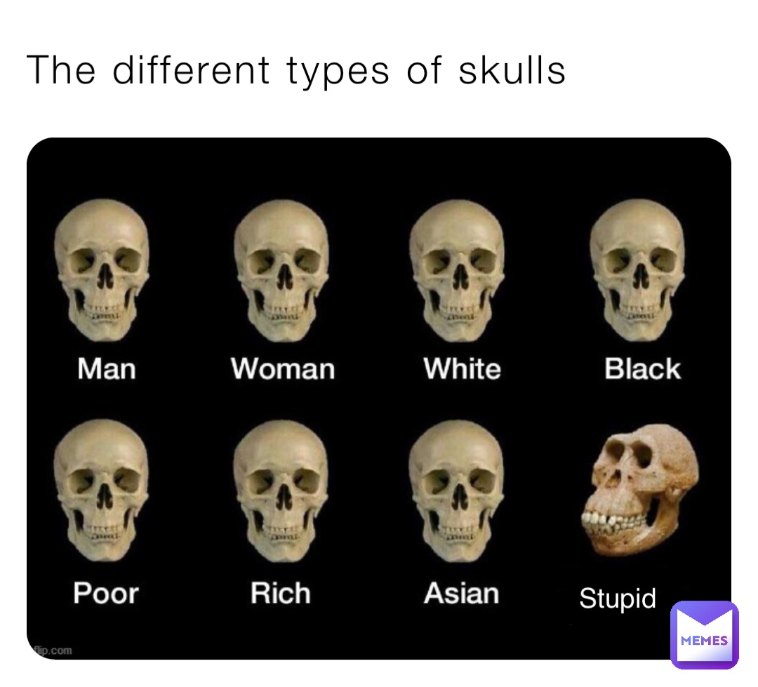 The different types of skulls Stupid