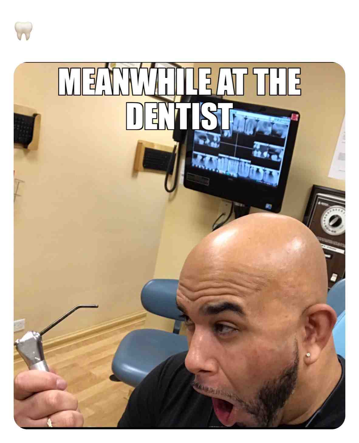 #memeofthedaystagramssrlife  #dentist  #memeofthedaystagramssrlife  #memeofthedaystagrams  #memeofthedaystagram  #memeofthedaystagram  #memeoftheday #memesdaily #meme4days