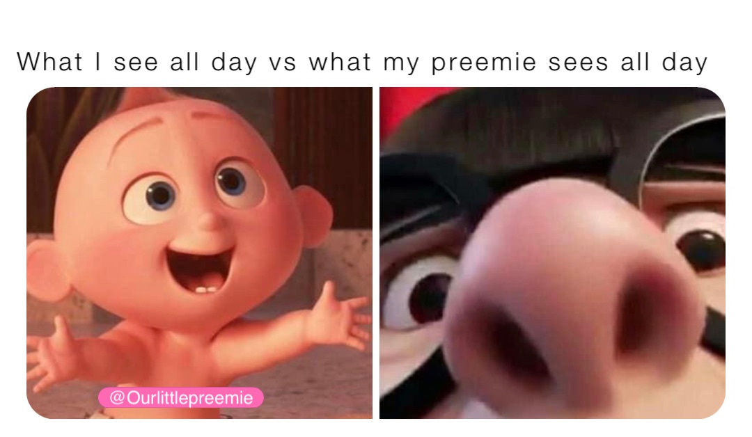 What I see all day vs what my preemie sees all day