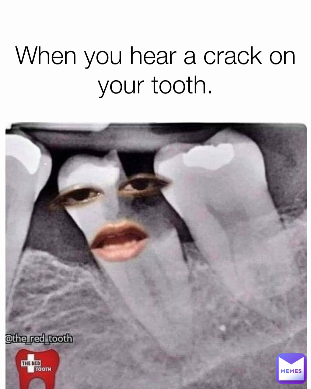 When you hear a crack on your tooth.