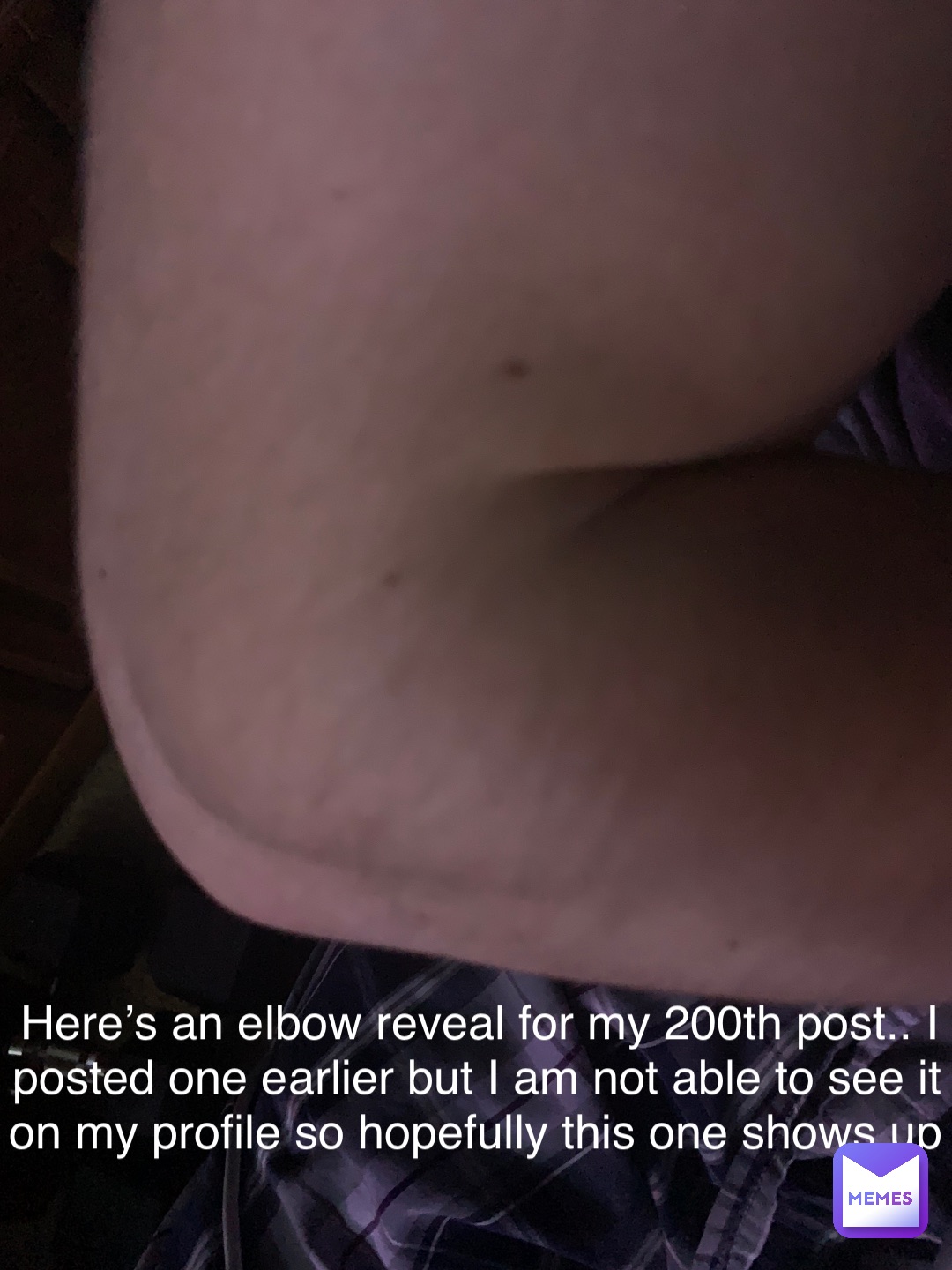 Here’s an elbow reveal for my 200th post.. I posted one earlier but I am not able to see it on my profile so hopefully this one shows up