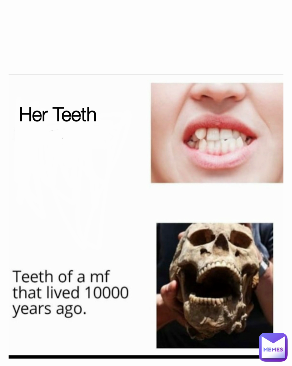 Her Teeth 