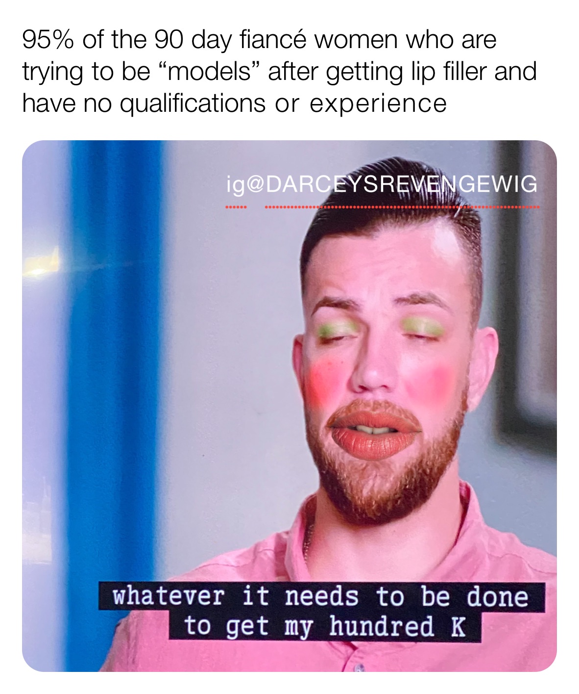 95% of the 90 day fiancé women who are trying to be “models” after getting lip filler and have no qualifications or experience 