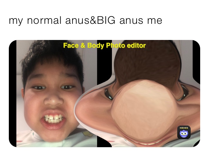 my normal anus&BIG anus me