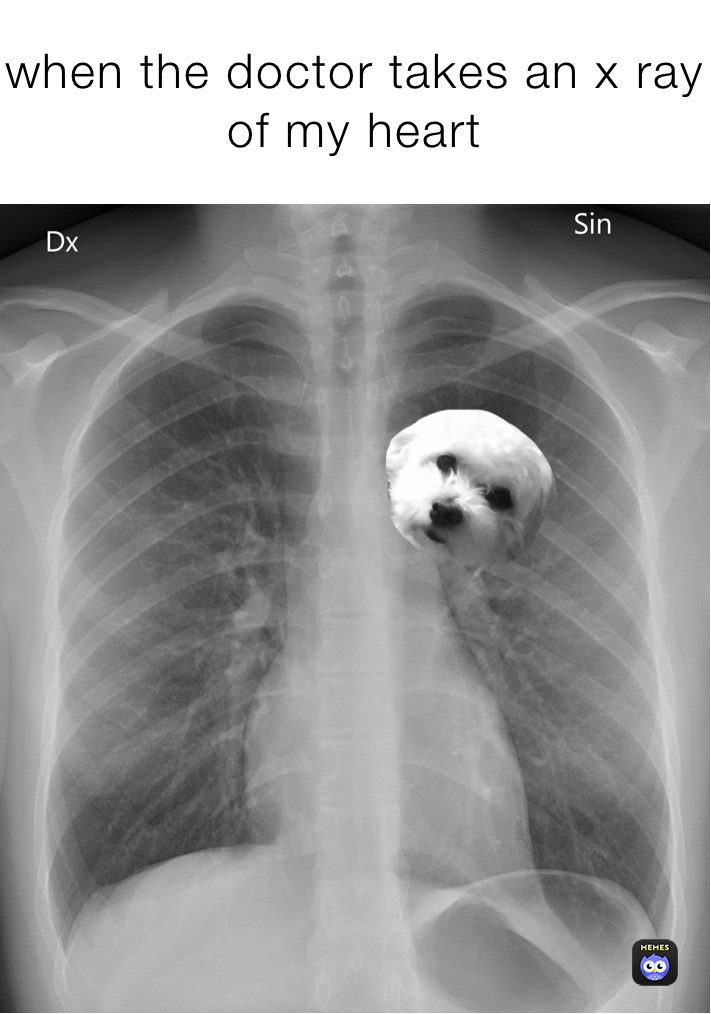 when the doctor takes an x ray of my heart | @6e7gd859jf | Memes