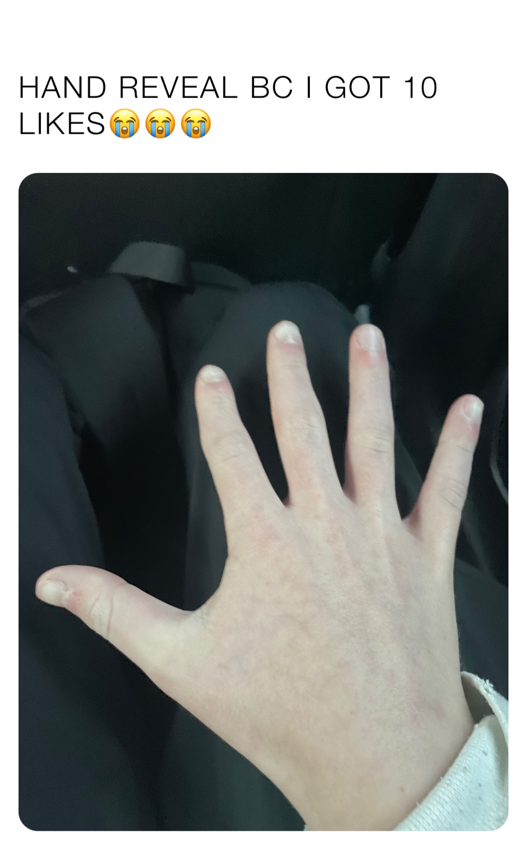 HAND REVEAL BC I GOT 10 LIKES😭😭😭
