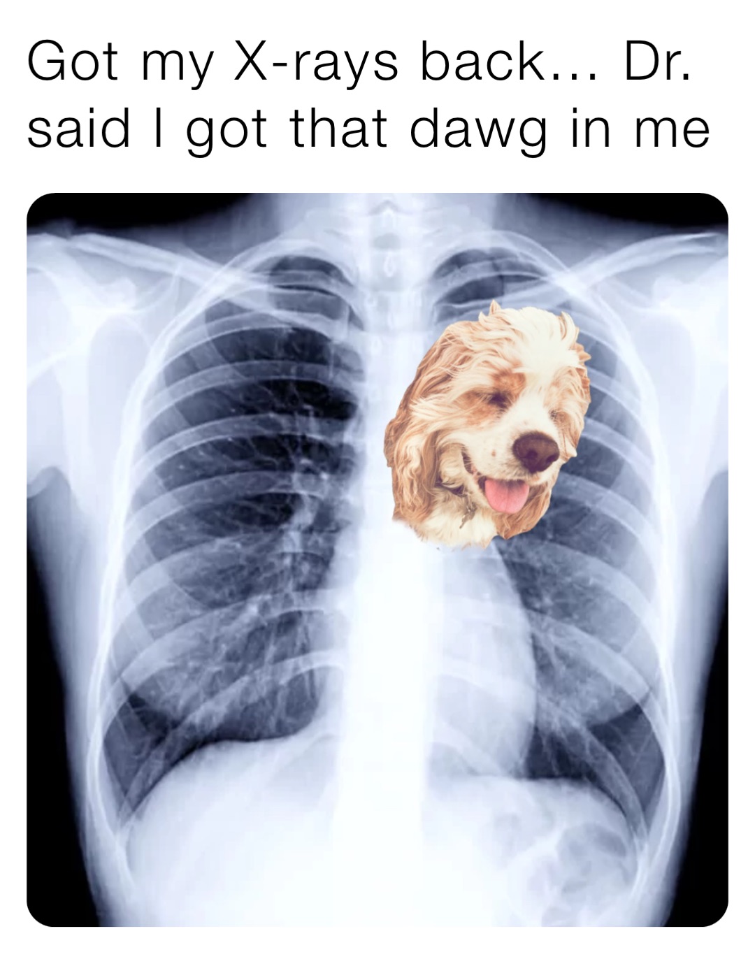 Got my X-rays back… Dr. said I got that dawg in me