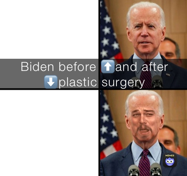 Biden before and after plastic surgery  Biden before ⬆️and after ⬇️plastic surgery 