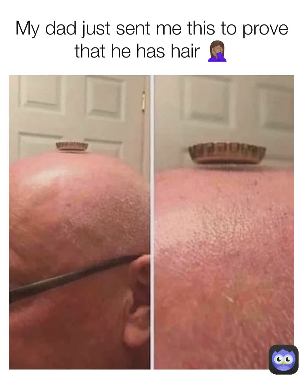 My Dad Just Sent Me This To Prove That He Has Hair 🤦🏽‍♀️ Memes 