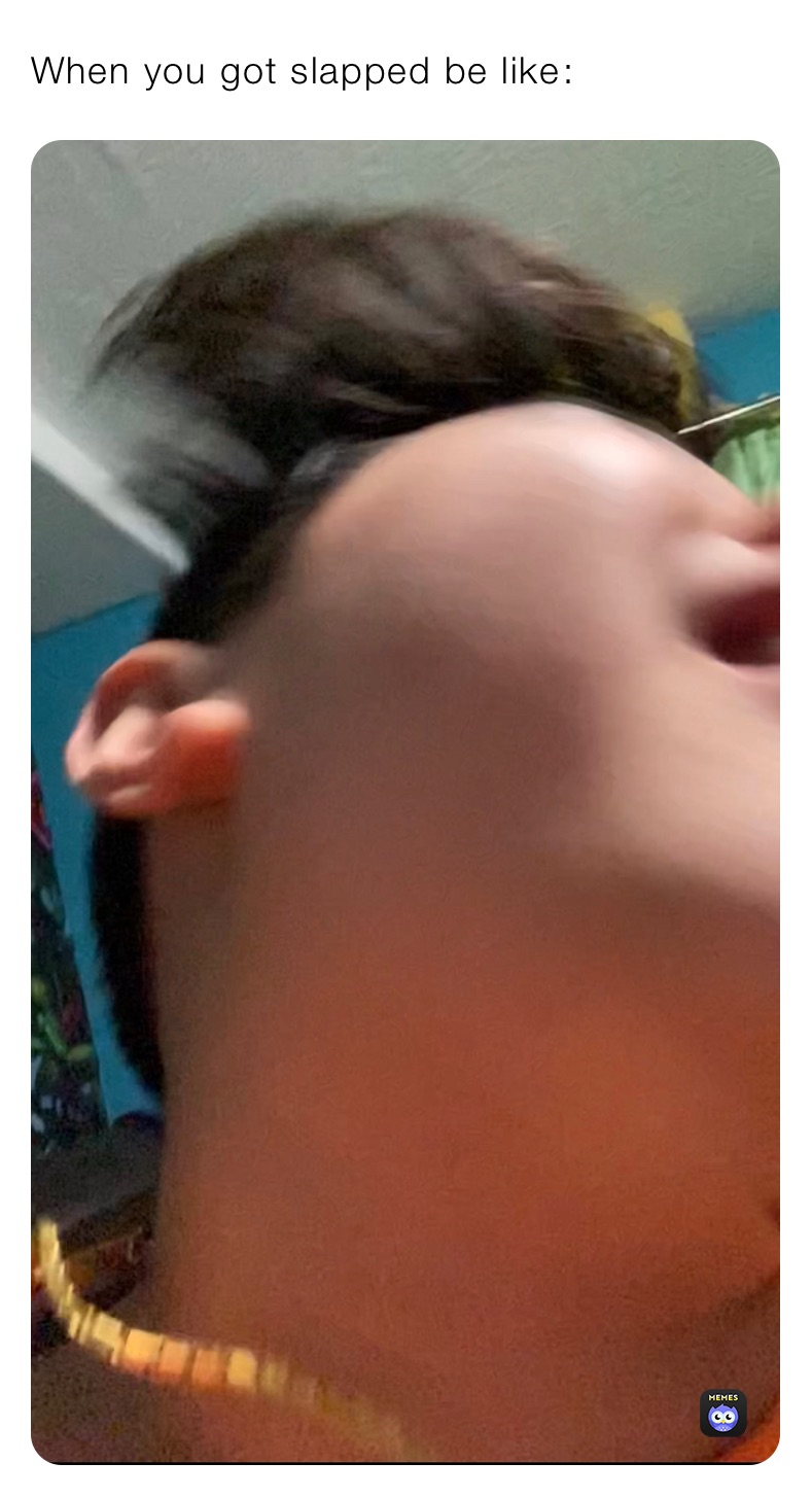 When you got slapped be like￼: