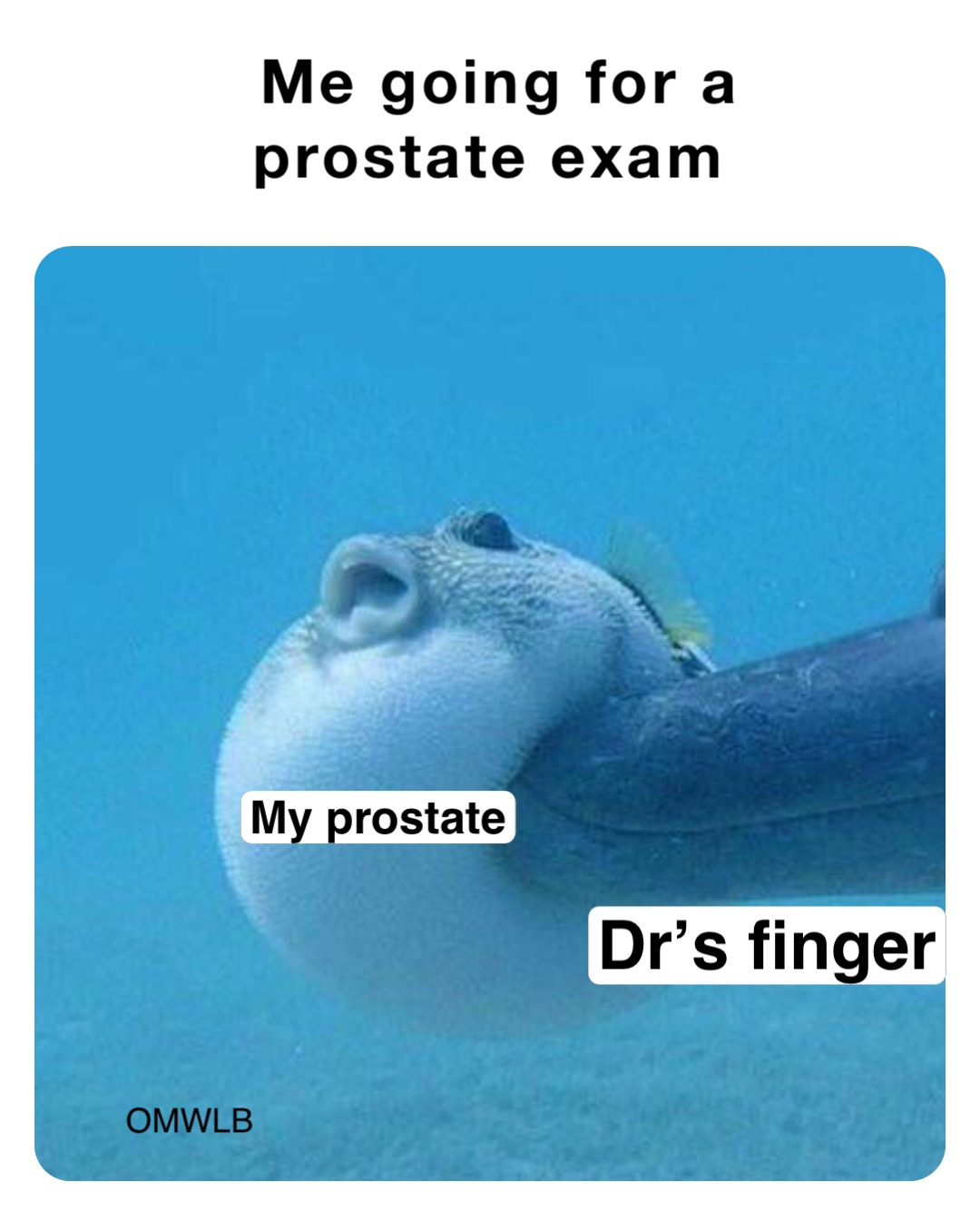 Me going for a 
prostate exam My prostate Dr’s finger