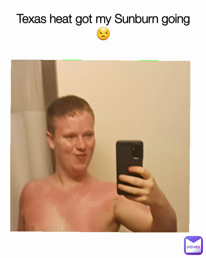 Texas heat got my Sunburn going 😒