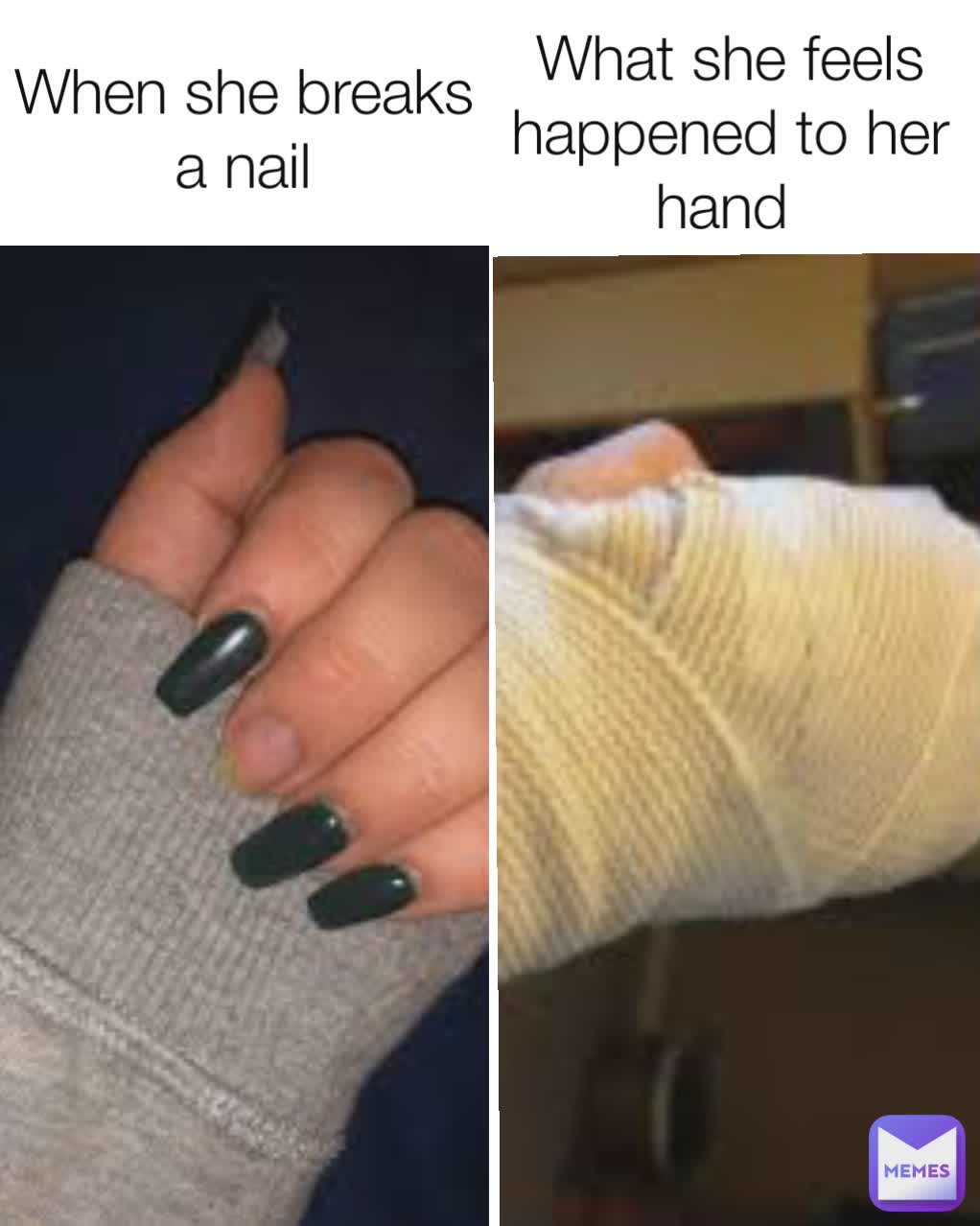 When she breaks a nail What she feels happened to her hand 