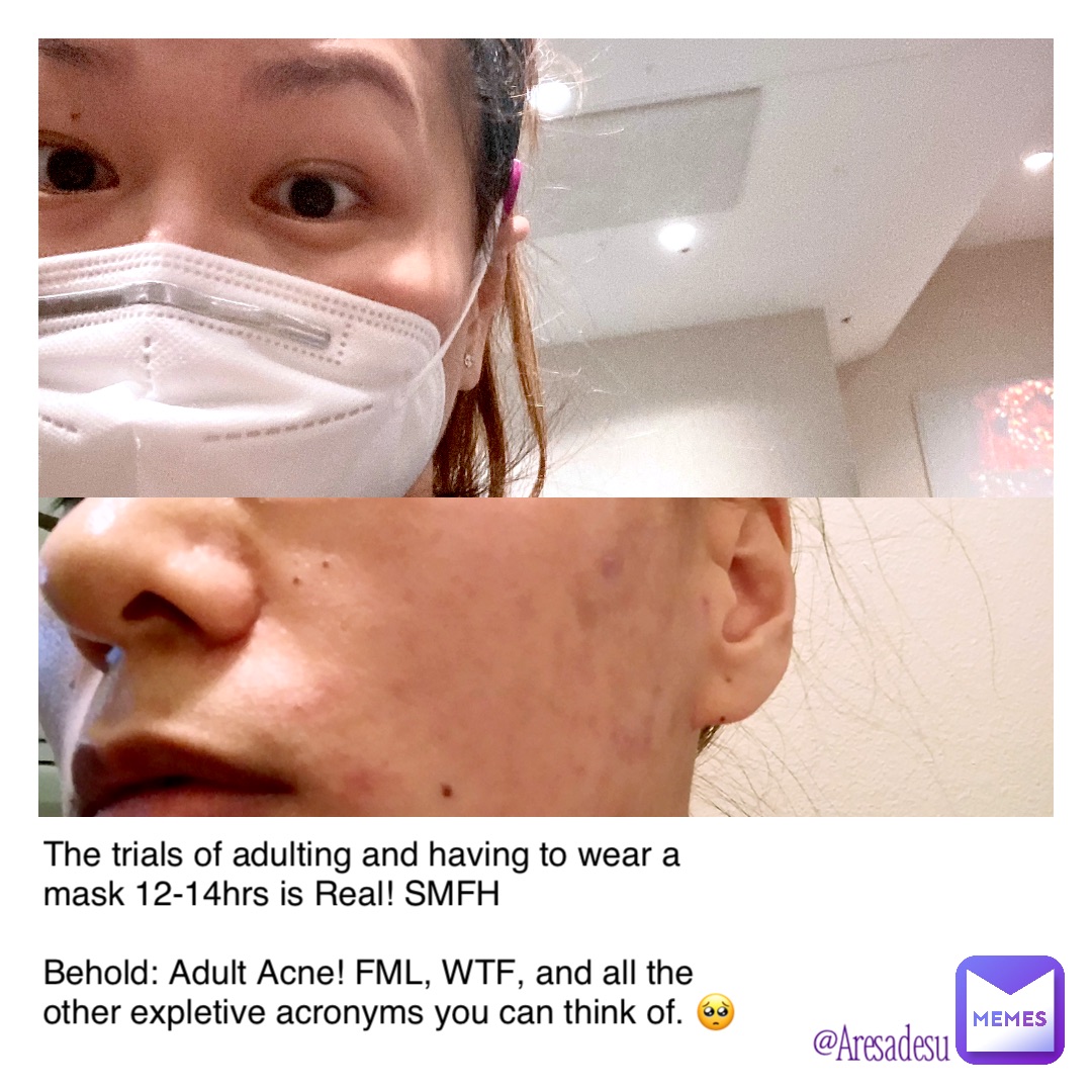 The trials of adulting and having to wear a mask 12-14hrs is Real! SMFH

Behold: Adult Acne! FML, WTF, and all the other expletive acronyms you can think of. 🥺