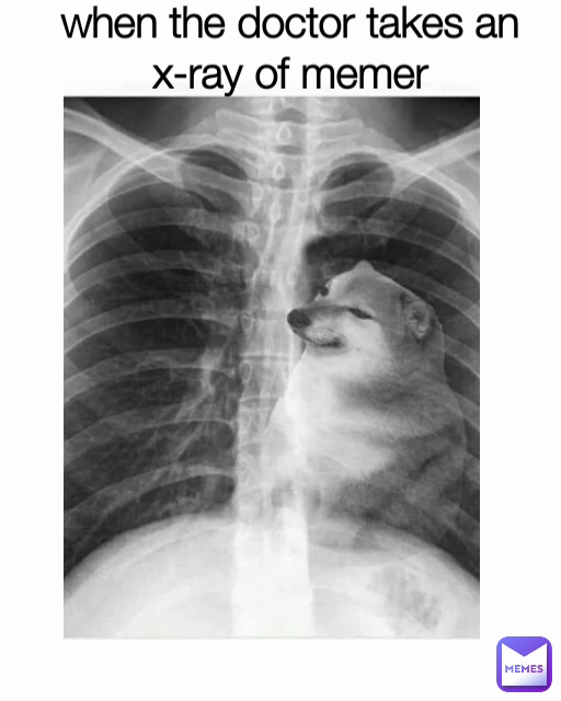 when the doctor takes an x-ray of memer