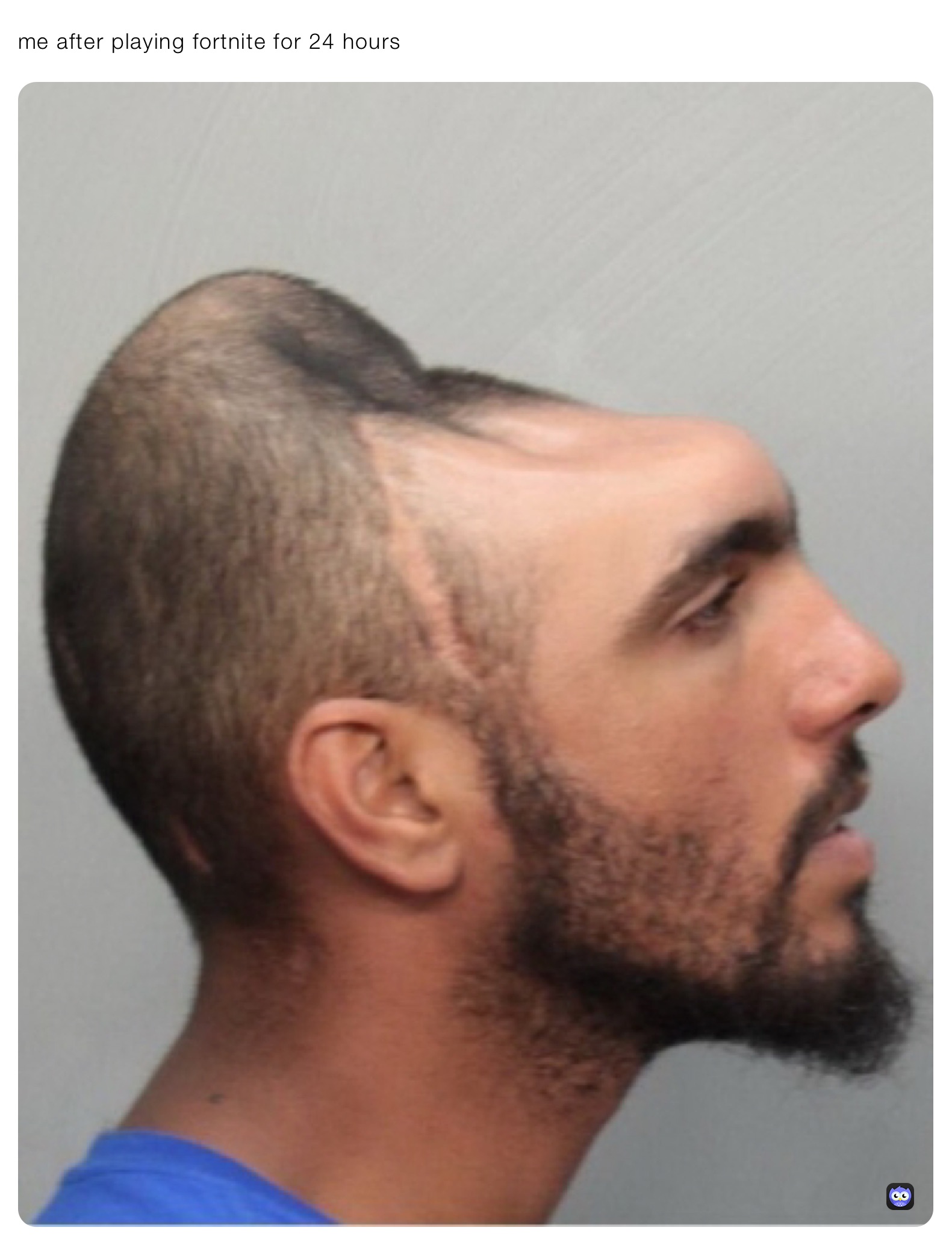 me after playing fortnite for 24 hours