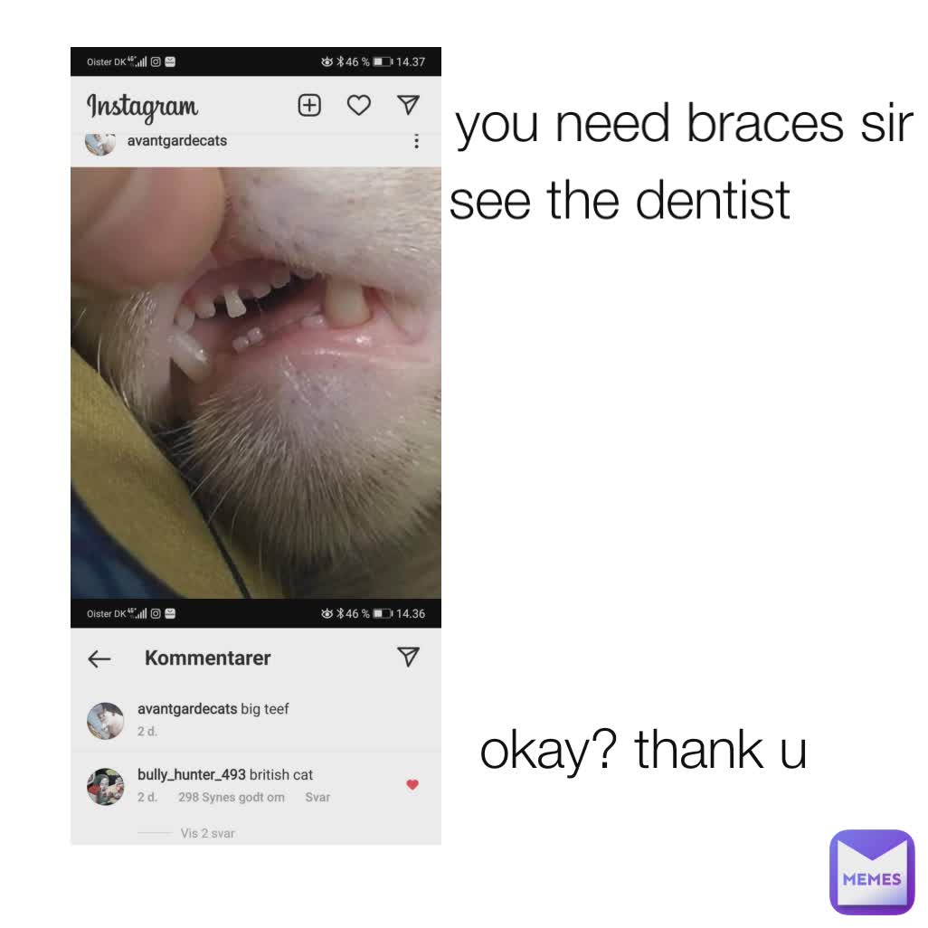 you need braces sir see the dentist okay? thank u