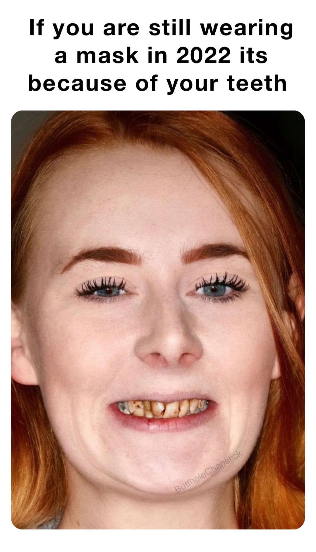 If you are still wearing a mask in 2022 its because of your teeth