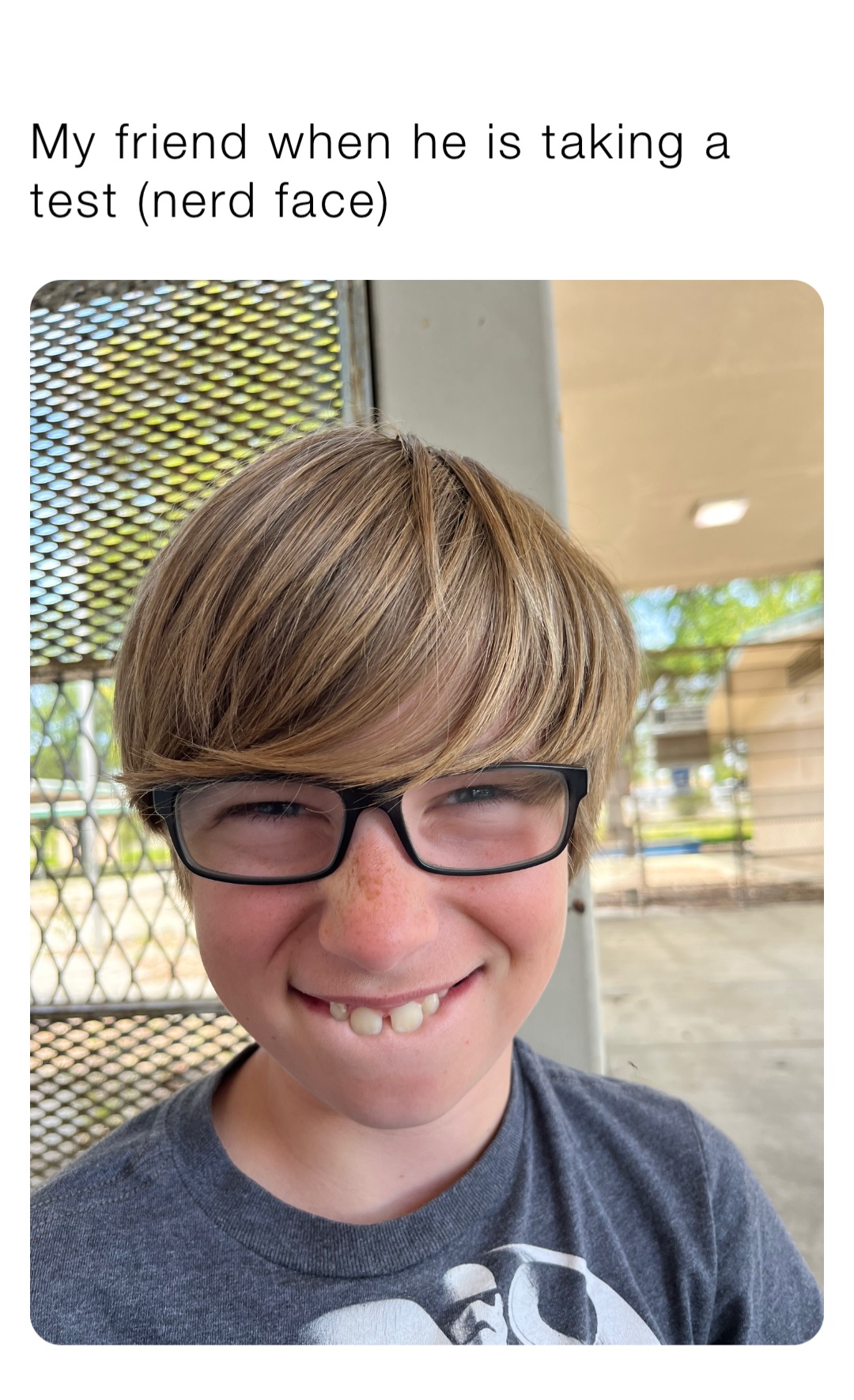 My friend when he is taking a test (nerd face)