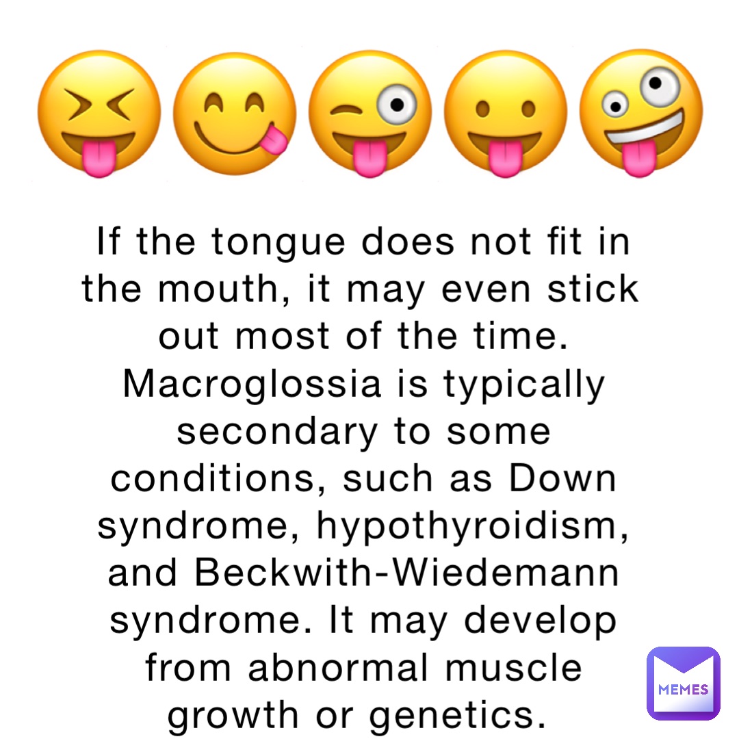 If the tongue does not fit in the mouth, it may even stick out most of the time. Macroglossia is typically secondary to some conditions, such as Down syndrome, hypothyroidism, and Beckwith-Wiedemann syndrome. It may develop from abnormal muscle growth or genetics. 😝😋😜😛🤪