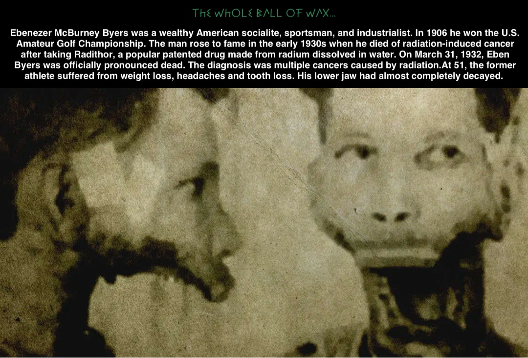 Double tap to edit Ebenezer McBurney Byers was a wealthy American socialite, sportsman, and industrialist. In 1906 he won the U.S. Amateur Golf Championship. The man rose to fame in the early 1930s when he died of radiation-induced cancer after taking Radithor, a popular patented drug made from radium dissolved in water. On March 31, 1932, Eben Byers was officially pronounced dead. The diagnosis was multiple cancers caused by radiation.At 51, the former athlete suffered from weight loss, headaches and tooth loss. His lower jaw had almost completely decayed.