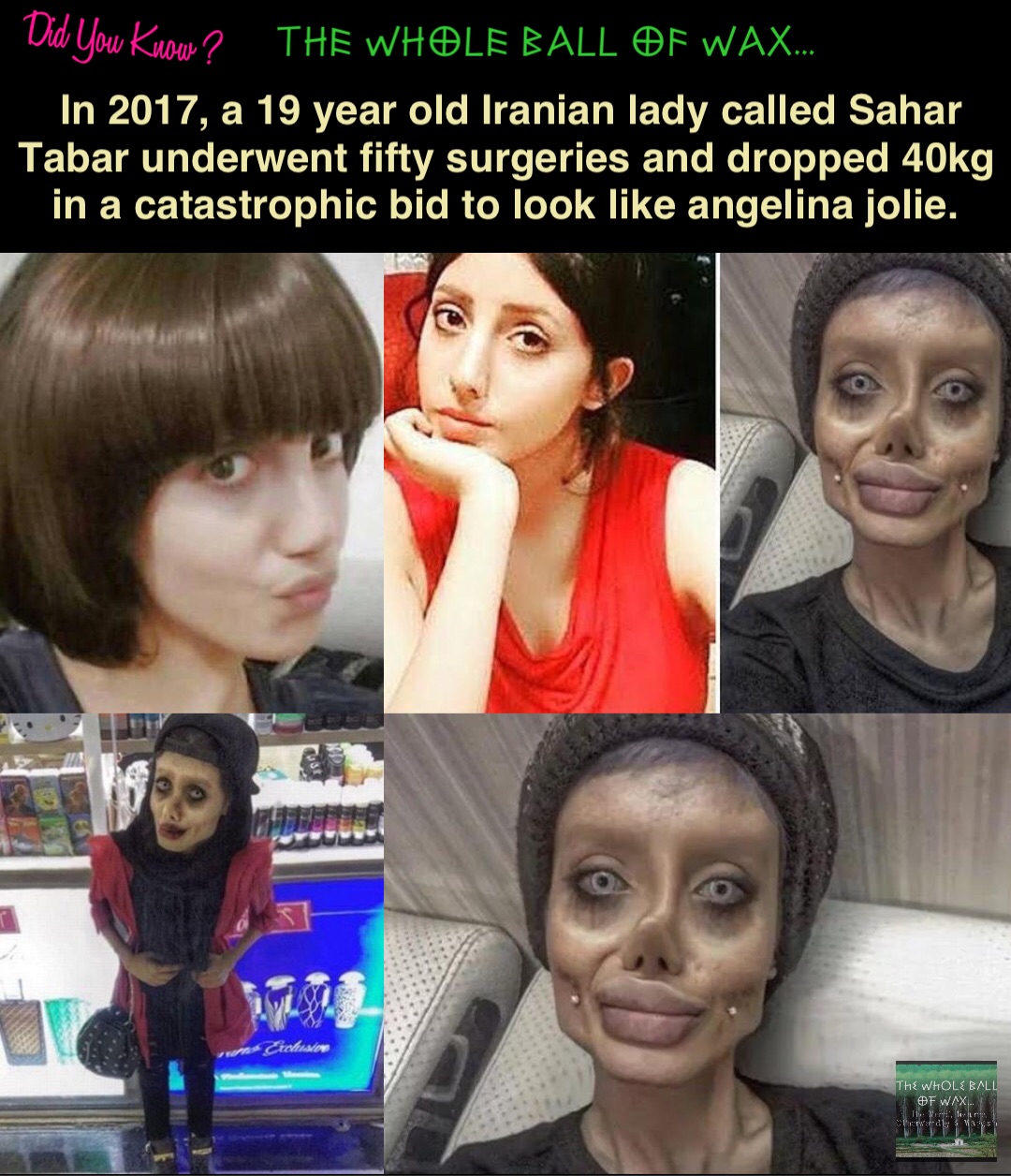 Double tap to edit In 2017, a 19 year old Iranian lady called Sahar Tabar underwent fifty surgeries and dropped 40kg in a catastrophic bid to look like angelina jolie.