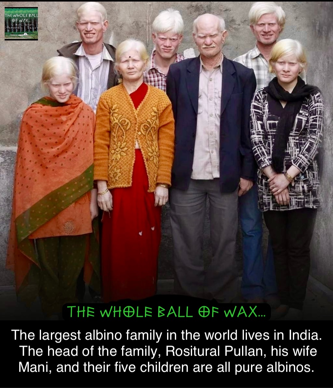 The largest albino family in the world lives in India. The head of the family, Rositural Pullan, his wife Mani, and their five children are all pure albinos.