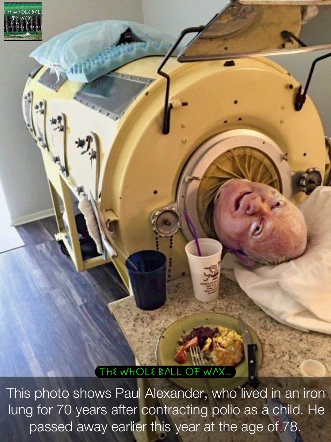 This photo shows Paul Alexander, who lived in an iron lung for 70 years after contracting polio as a child. He passed away earlier this year at the age of 78.