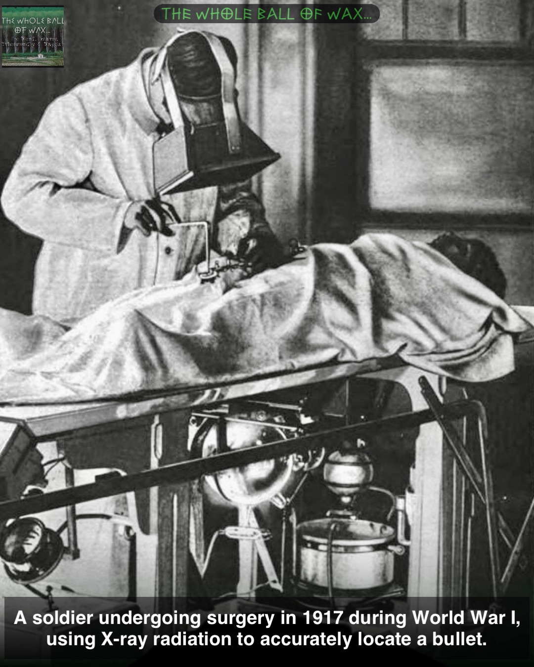 A soldier undergoing surgery in 1917 during World War I, 
using X-ray radiation to accurately locate a bullet.